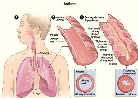 Being Exposed to Good Bacteria Early in Life Could Prevent Asthma Developing
