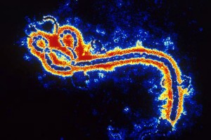 Ebola Virus Can Kill The People